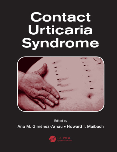 Contact Urticaria Syndrome
