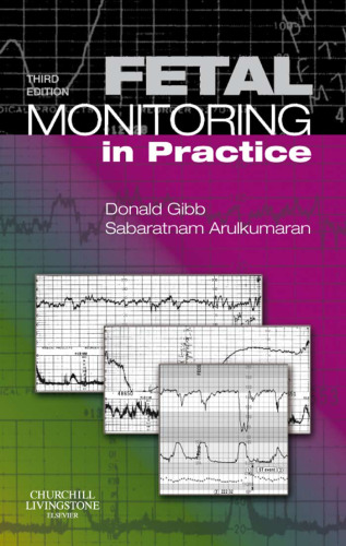 Fetal monitoring in practice