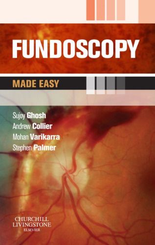 Fundoscopy made easy