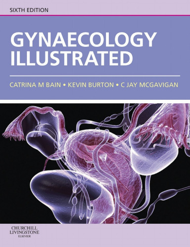 Gynaecology illustrated