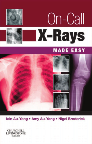 On-call x-rays made easy