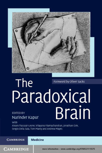 The paradoxical brain