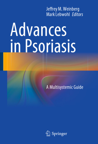 Advances in Psoriasis: A Multisystemic Guide