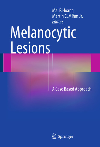 Melanocytic Lesions: A Case Based Approach
