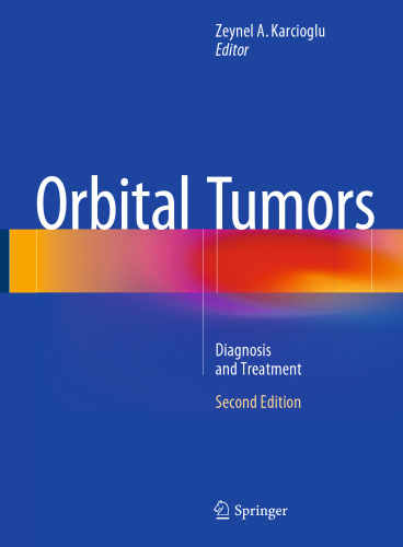 Orbital Tumors: Diagnosis and Treatment