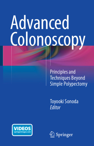 Advanced Colonoscopy: Principles and Techniques Beyond Simple Polypectomy