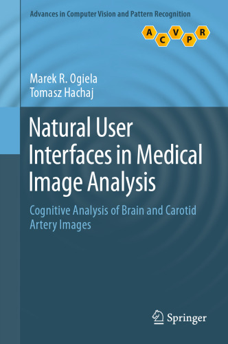 Natural User Interfaces in Medical Image Analysis: Cognitive Analysis of Brain and Carotid Artery Images