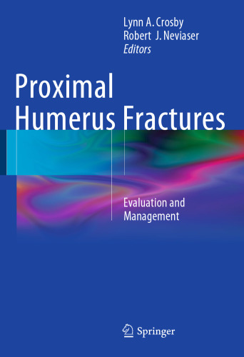 Proximal Humerus Fractures: Evaluation and Management