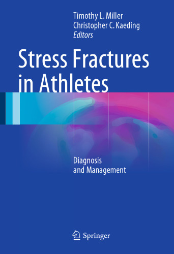 Stress Fractures in Athletes: Diagnosis and Management