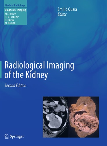 Radiological Imaging of the Kidney