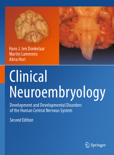 Clinical Neuroembryology: Development and Developmental Disorders of the Human Central Nervous System
