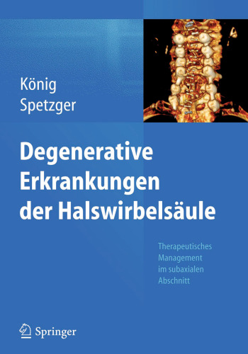Degenerative Erkrankungen der Halswirbelsäule: Therapeutisches Management im subaxialen Abschnitt