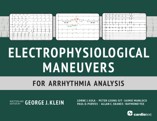 Electrophysiological Maneuvers for Arrhythmia Analysis