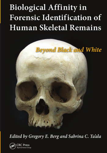 Biological Affinity in Forensic Identification of Human Skeletal Remains: Beyond Black and White