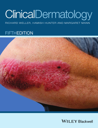 Clinical Dermatology