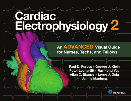 Cardiac Electrophysiology 2: An Advanced Visual Guide for Nurses, Techs, and Fellows