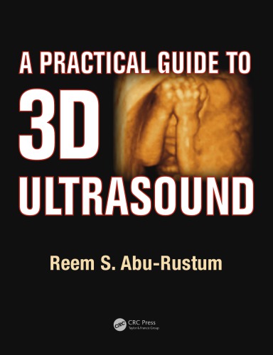 A Practical Guide to 3D Ultrasound