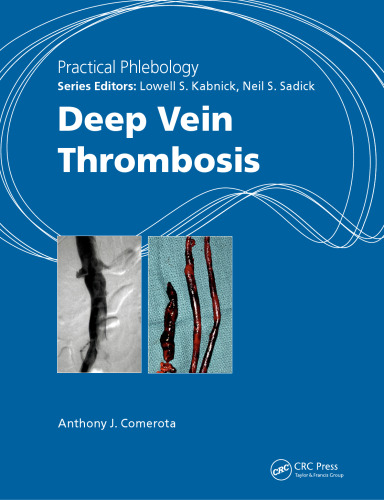 Practical Phlebology: Deep Vein Thrombosis