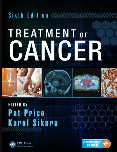 Treatment of Cancer Sixth Edition