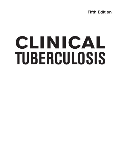 Clinical Tuberculosis, Fifth Edition