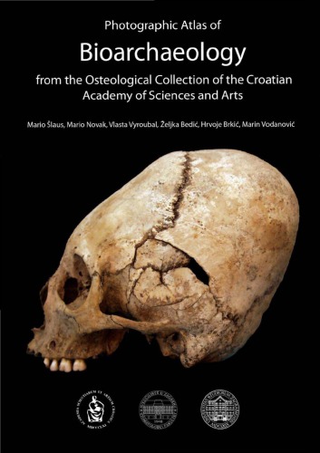 Photographic Atlas of Human Bioarchaeology from the Osteological Collections of the Croatian Academy of Sciences and Arts