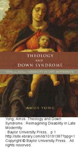 Theology and Down Syndrome: Reimagining Disability in Late Modernity