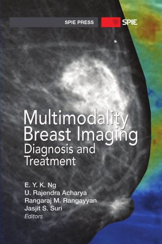Multimodality Breast Imaging: Diagnosis and Treatment