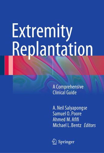 Extremity Replantation: A Comprehensive Clinical Guide