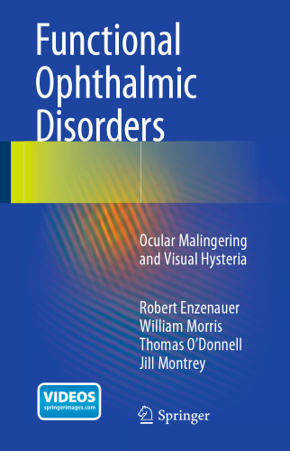 Functional Ophthalmic Disorders: Ocular Malingering and Visual Hysteria
