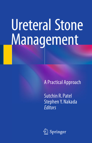 Ureteral Stone Management: A Practical Approach
