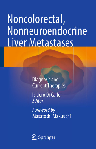 Noncolorectal, Nonneuroendocrine Liver Metastases: Diagnosis and Current Therapies