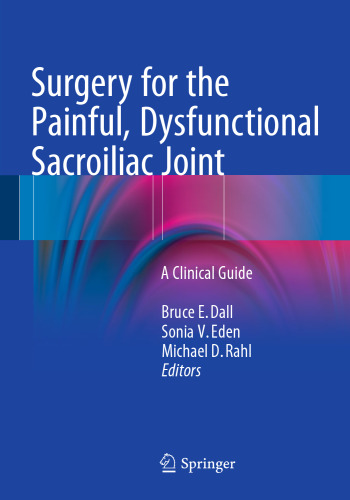Surgery for the Painful, Dysfunctional Sacroiliac Joint: A Clinical Guide