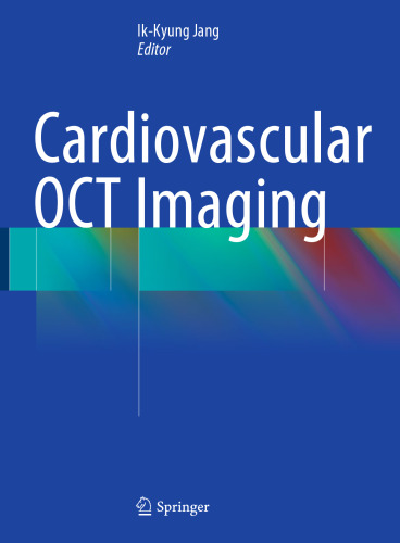 Cardiovascular OCT Imaging