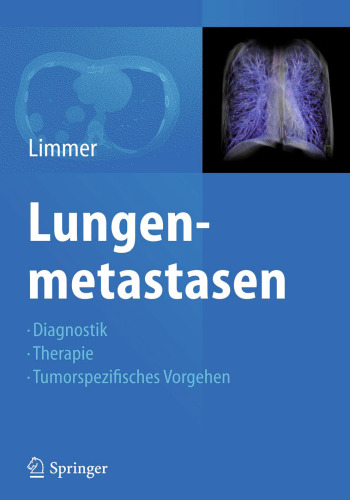 Lungenmetastasen: Diagnostik - Therapie - Tumorspezifisches Vorgehen