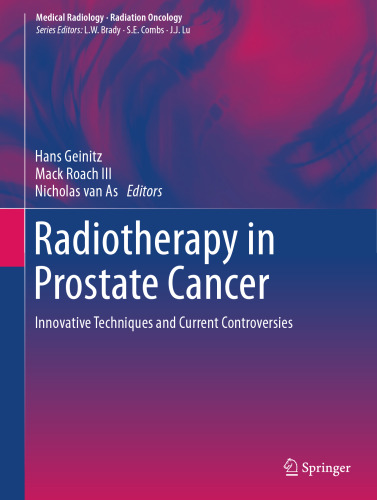 Radiotherapy in Prostate Cancer: Innovative Techniques and Current Controversies