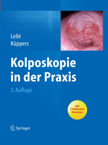 Kolposkopie in der Praxis