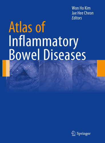 Atlas of Inflammatory Bowel Diseases