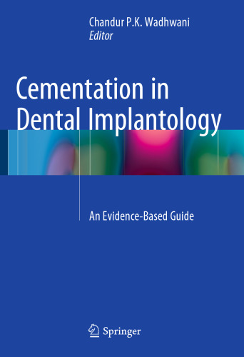 Cementation in Dental Implantology: An Evidence-Based Guide