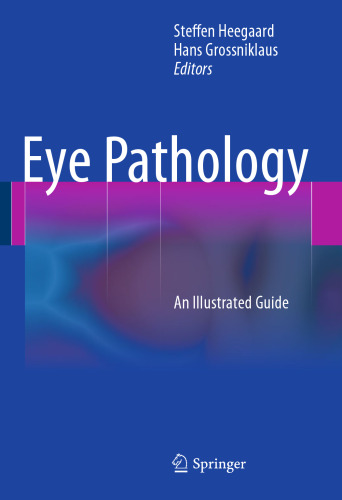 Eye Pathology: An Illustrated Guide