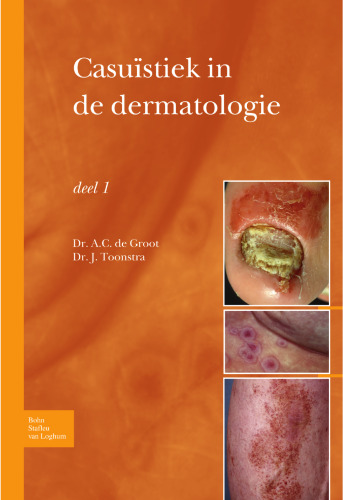 Casuïstiek in de dermatologie deel I