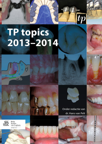 TP topics 2013-2014
