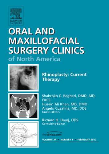 Rhinoplasty: Current Therapy, An Issue of Oral and Maxillofacial Surgery Clinics, 1e