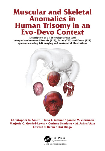 Muscular and Skeletal Anomalies in Human Trisomy in an Evo-Devo Context: Description of a T18 Cyclopic Fetus and Comparison Between Edwards