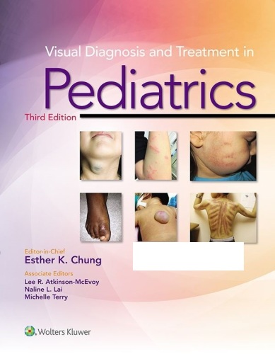 Visual Diagnosis and Treatment in Pediatrics