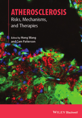 Atherosclerosis: Risks, Mechanisms, and Therapies