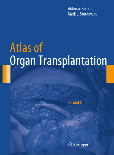 Atlas of Organ Transplantation