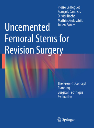 Uncemented Femoral Stems for Revision Surgery: The Press-fit Concept - Planning - Surgical Technique - Evaluation