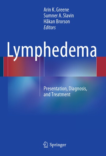 Lymphedema: Presentation, Diagnosis, and Treatment