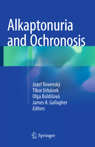 Alkaptonuria and Ochronosis