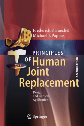 Principles of Human Joint Replacement: Design and Clinical Application